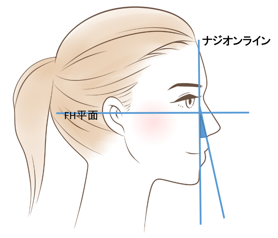 綺麗な横顔の5つの基準とは 矯正治療と横顔の関係 長崎の矯正専門 すずき矯正歯科