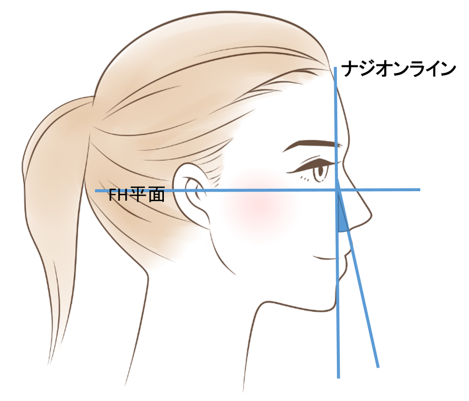 上唇の傾斜度