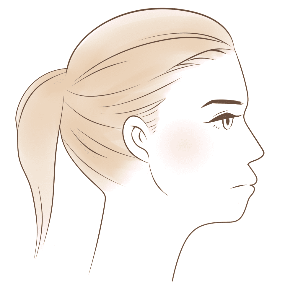 口元突出の原因は出っ歯 それともアデノイド顔貌 どちらも矯正治療で治る 長崎の矯正専門 すずき矯正歯科