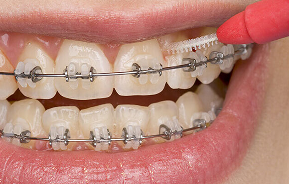 外科的矯正歯科治療に対応